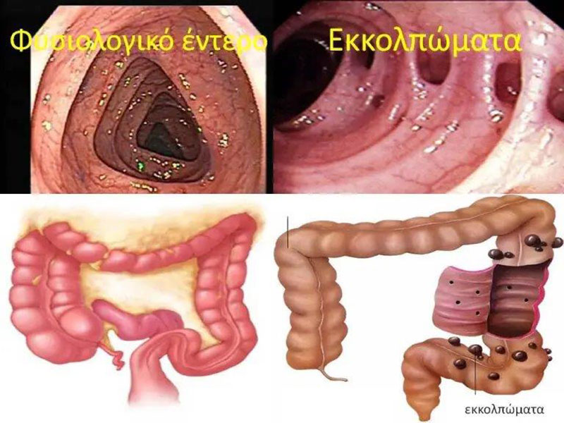 ΑΡΒΑΝΙΤΗ ΒΑΣΙΛΙΚΗ: Φωτογραφίες & Βίντεο