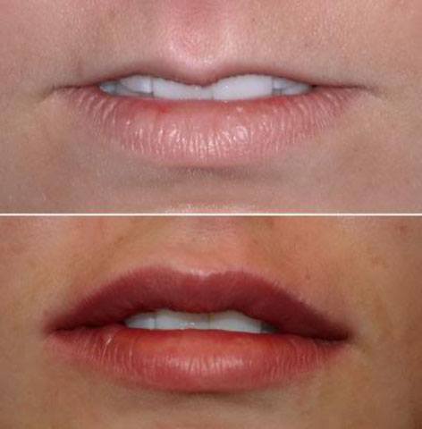 ATHENS PLASTIC SURGERY CENTER - ΔΙΑΛΥΝΑΚΗΣ ΚΩΝΣΤΑΝΤΙΝΟΣ: Φωτογραφίες & Βίντεο