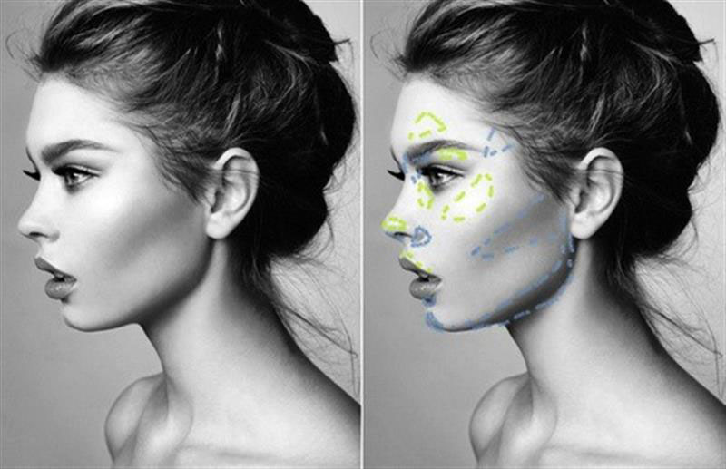 ATHENS PLASTIC SURGERY CENTER - ΔΙΑΛΥΝΑΚΗΣ ΚΩΝΣΤΑΝΤΙΝΟΣ: Φωτογραφίες & Βίντεο