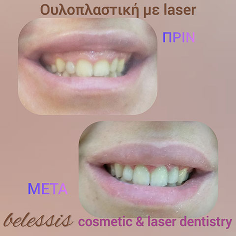 BELESIS I. LAMPROS DDS, LSO, MSc: Φωτογραφίες & Βίντεο