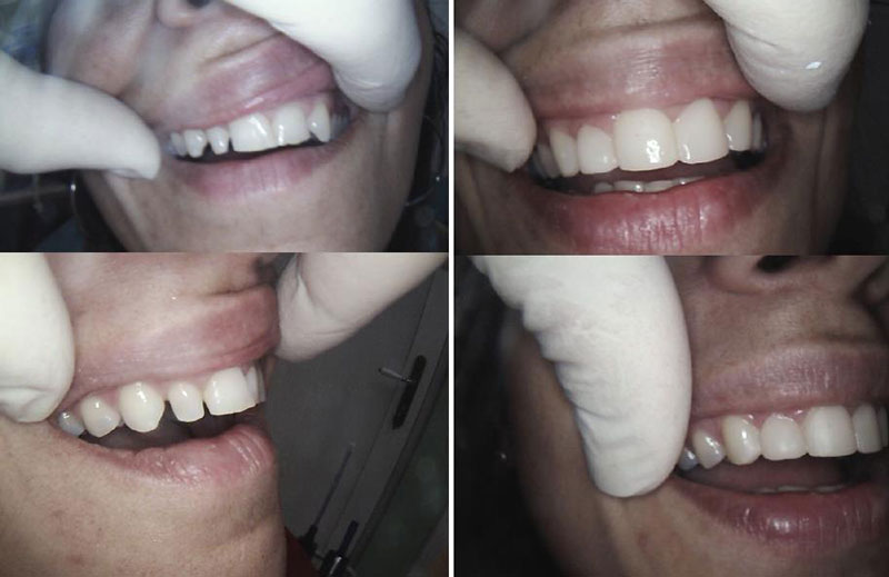 BELESIS I. LAMPROS DDS, LSO, MSc: Φωτογραφίες & Βίντεο