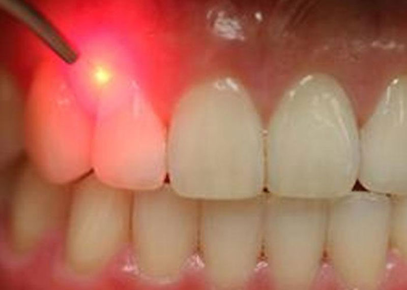BELESIS I. LAMPROS DDS, LSO, MSc: Φωτογραφίες & Βίντεο