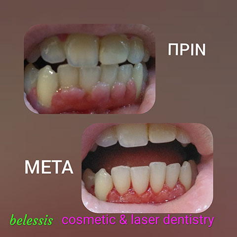 BELESIS I. LAMPROS DDS, LSO, MSc: Φωτογραφίες & Βίντεο