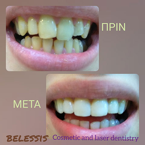 BELESIS I. LAMPROS DDS, LSO, MSc: Φωτογραφίες & Βίντεο