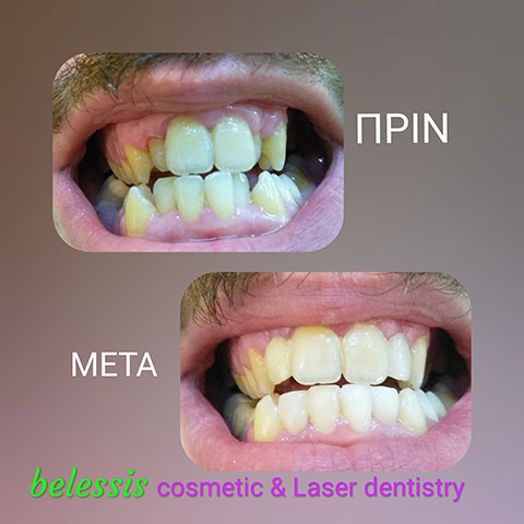 BELESIS I. LAMPROS DDS, LSO, MSc: Φωτογραφίες & Βίντεο