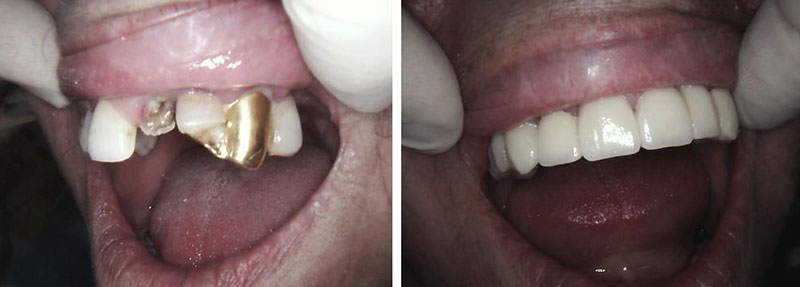 BELESIS I. LAMPROS DDS, LSO, MSc: Φωτογραφίες & Βίντεο