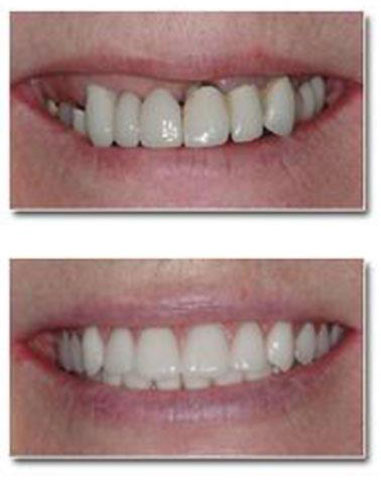 BELESIS I. LAMPROS DDS, LSO, MSc: Φωτογραφίες & Βίντεο