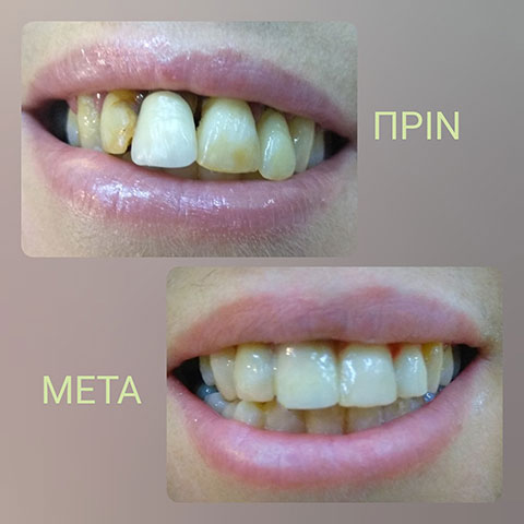 BELESIS I. LAMPROS DDS, LSO, MSc: Φωτογραφίες & Βίντεο