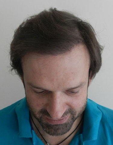 BERGMANN KORD: Φωτογραφίες & Βίντεο