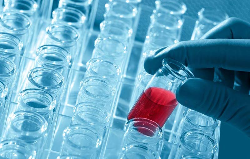 BIOANALYSIS - LOULELIS D. VASILIS: Φωτογραφίες & Βίντεο