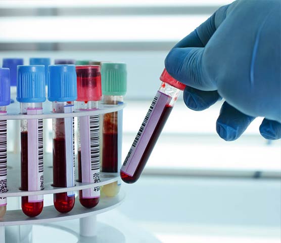 BIOANALYSIS - ΛΟΥΛΕΛΗΣ Δ. ΒΑΣΙΛΗΣ: Φωτογραφίες & Βίντεο