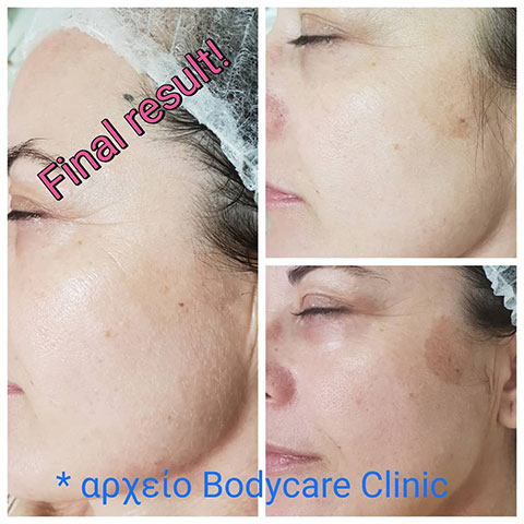 BODY CARE CLINIC - ANDRIOPOULOU CHARA: Φωτογραφίες & Βίντεο