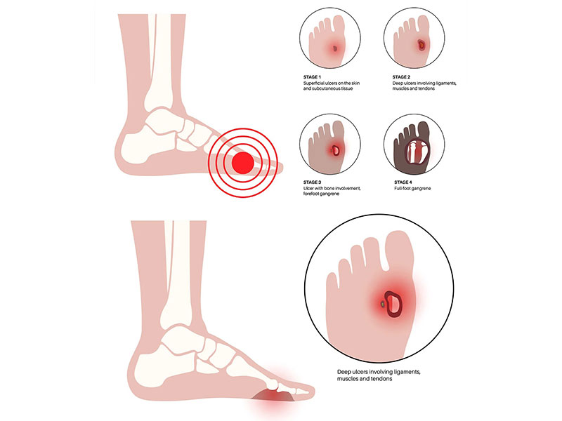 BONTINIS ALKIS MD, MSC - VENOUS VASCULAR CLINIC: Φωτογραφίες & Βίντεο