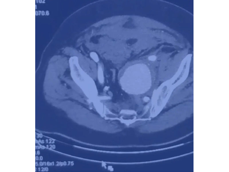 BONTINIS ALKIS MD, MSC - VENOUS VASCULAR CLINIC: Φωτογραφίες & Βίντεο