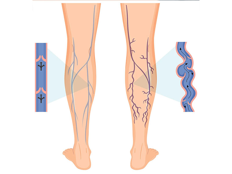 BONTINIS ALKIS MD, MSC - VENOUS VASCULAR CLINIC: Φωτογραφίες & Βίντεο