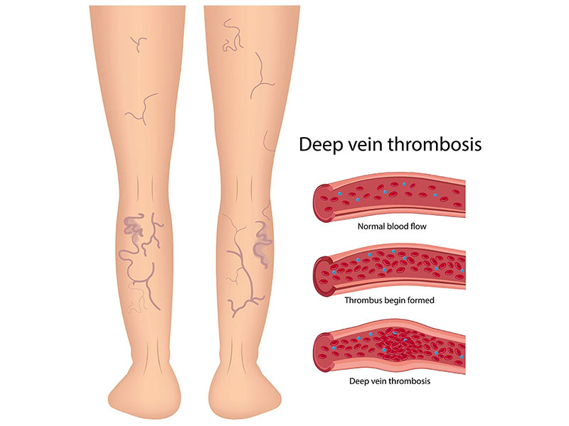 BONTINIS ALKIS MD, MSC - VENOUS VASCULAR CLINIC: Φωτογραφίες & Βίντεο
