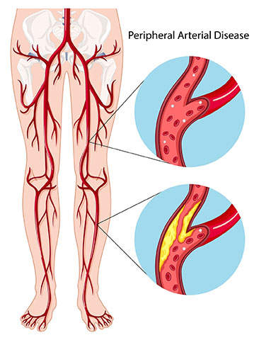 BONTINIS EVAGGELOS - VENOUS VASCULAR CLINIC: Φωτογραφίες & Βίντεο