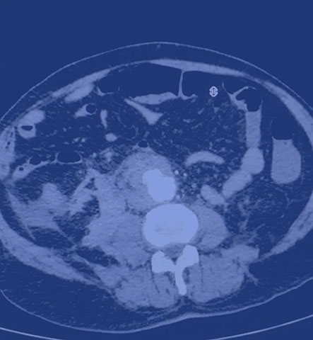 BONTINIS EVAGGELOS - VENOUS VASCULAR CLINIC: Φωτογραφίες & Βίντεο
