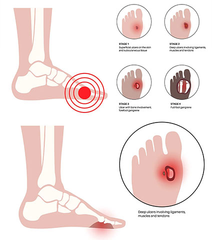 BONTINIS EVAGGELOS - VENOUS VASCULAR CLINIC: Φωτογραφίες & Βίντεο