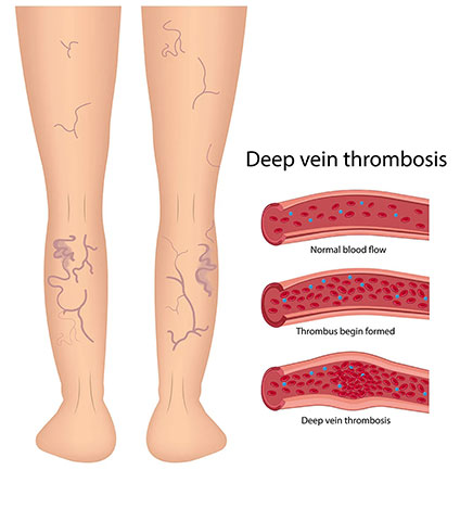 BONTINIS EVAGGELOS - VENOUS VASCULAR CLINIC: Φωτογραφίες & Βίντεο