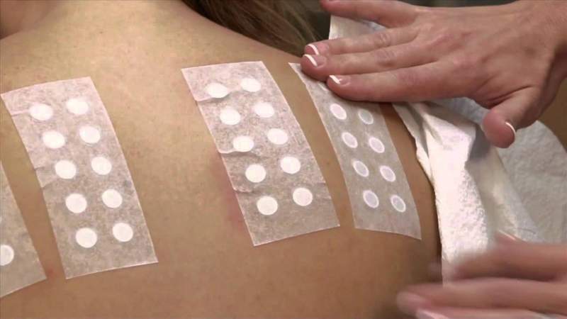 Patch tests
