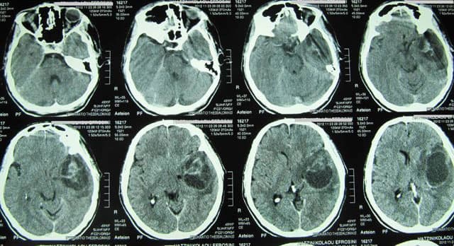 BRIZAS STERGIOS MD, MSc: Φωτογραφίες & Βίντεο