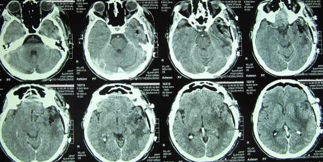 BRIZAS STERGIOS MD, MSc: Φωτογραφίες & Βίντεο