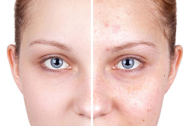 CG DERMA - GKINTZOU CHRISTINA M.D.: Φωτογραφίες & Βίντεο