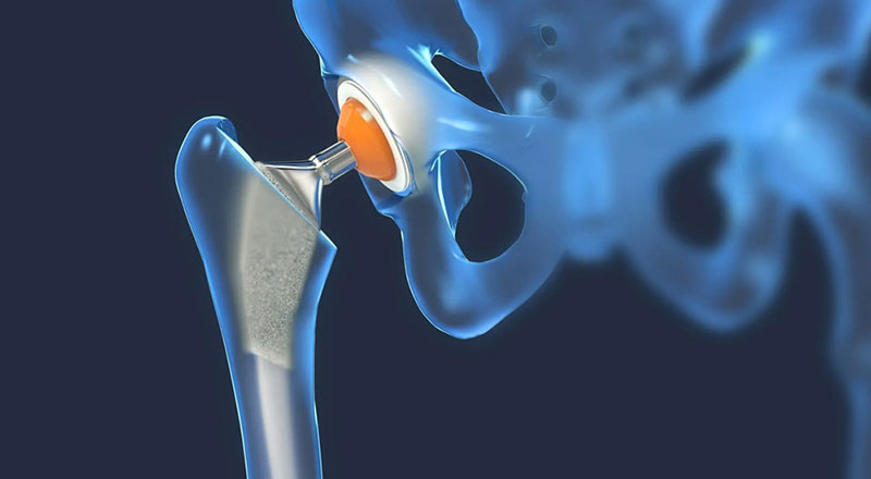 CHARISIS MICHAIL MD, Msc: Φωτογραφίες & Βίντεο