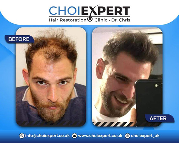 CHOIEXPERT - TSAKALOS CHRISTOS: Φωτογραφίες & Βίντεο
