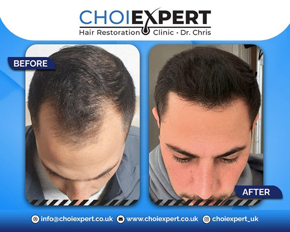 CHOIEXPERT - TSAKALOS CHRISTOS: Φωτογραφίες & Βίντεο