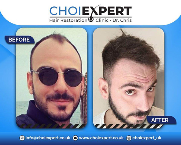 CHOIEXPERT - TSAKALOS CHRISTOS: Φωτογραφίες & Βίντεο