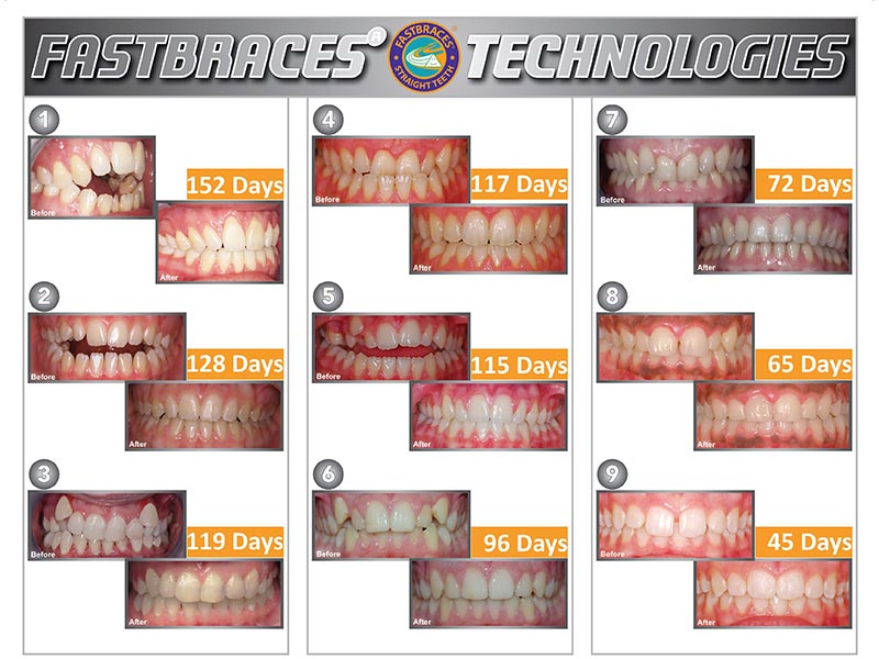 CHRYSOPOULOS KOSMAS DDS, MClinDent - KIDS DENT - FASTBRACES RHODES: Φωτογραφίες & Βίντεο