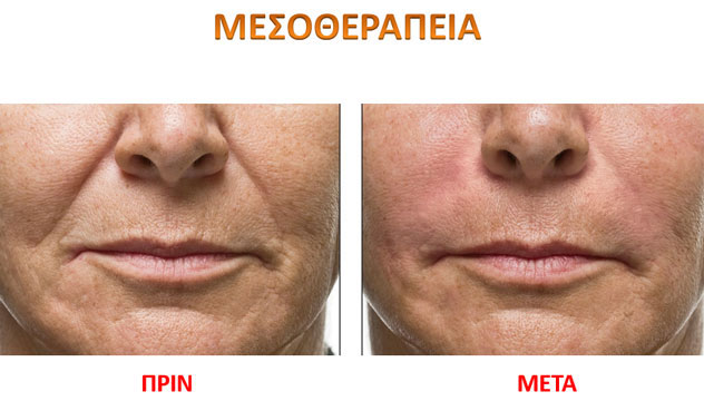 DELIGIANNI AFRODITI: Φωτογραφίες & Βίντεο