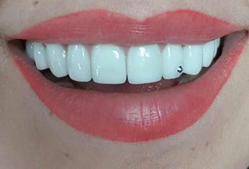 DENTALOLIS.GR - SYGCHRONES ODONTIATRIKES ERGASIES LOLIS EVAGGELOS & LOLIS ANTREAS EE: Φωτογραφίες & Βίντεο