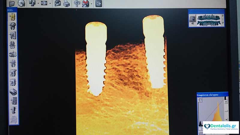 DENTALOLIS.GR - SYGCHRONES ODONTIATRIKES ERGASIES LOLIS EVAGGELOS & LOLIS ANTREAS EE: Φωτογραφίες & Βίντεο