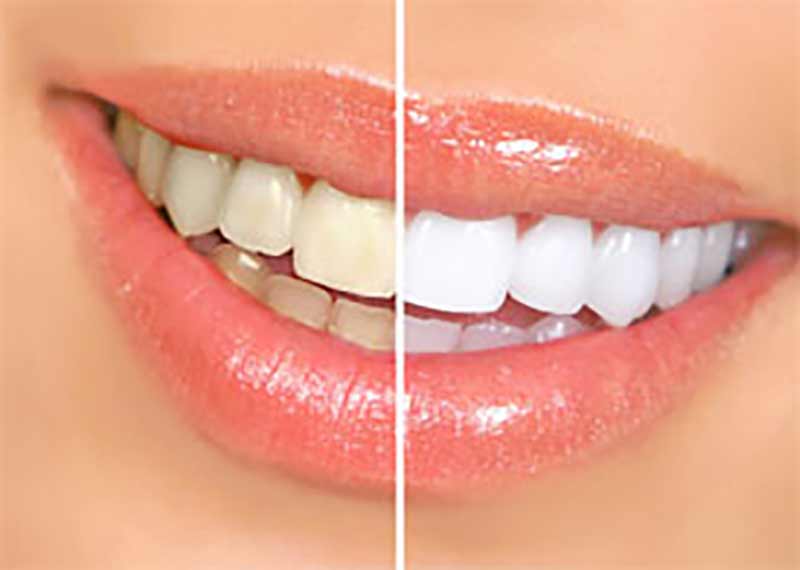DENTALOLIS.GR - SYGCHRONES ODONTIATRIKES ERGASIES LOLIS EVAGGELOS & LOLIS ANTREAS EE: Φωτογραφίες & Βίντεο
