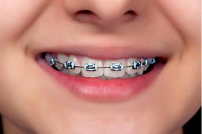 DENTALOLIS.GR - SYGCHRONES ODONTIATRIKES ERGASIES LOLIS EVAGGELOS & LOLIS ANTREAS EE: Φωτογραφίες & Βίντεο
