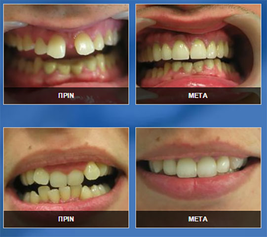 DENTAL 88 - ΠΟΥΛΚΑ - ΝΙΒΟΥΡΛΗΣ - ΚΑΡΑΚΑΣΙΔΗΣ: Φωτογραφίες & Βίντεο