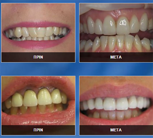 DENTAL 88 - ΠΟΥΛΚΑ - ΝΙΒΟΥΡΛΗΣ - ΚΑΡΑΚΑΣΙΔΗΣ: Φωτογραφίες & Βίντεο
