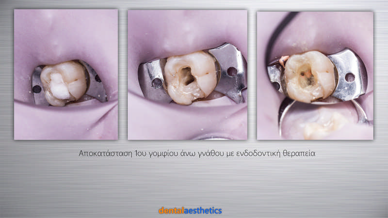 DENTAL AESTHETICS - TRIADAS STAVROS D.D.S.: Φωτογραφίες & Βίντεο
