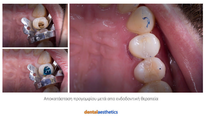 DENTAL AESTHETICS - TRIADAS STAVROS D.D.S.: Φωτογραφίες & Βίντεο