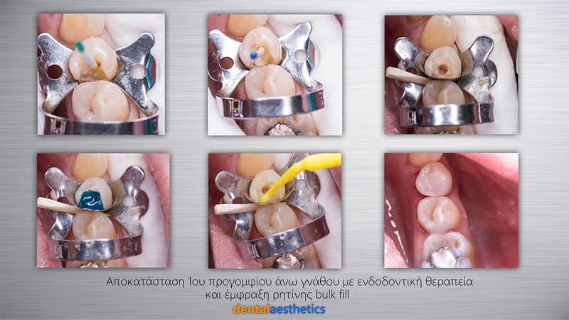 DENTAL AESTHETICS - TRIADAS STAVROS D.D.S.: Φωτογραφίες & Βίντεο