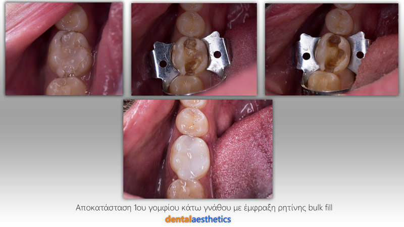 DENTAL AESTHETICS - TRIADAS STAVROS D.D.S.: Φωτογραφίες & Βίντεο