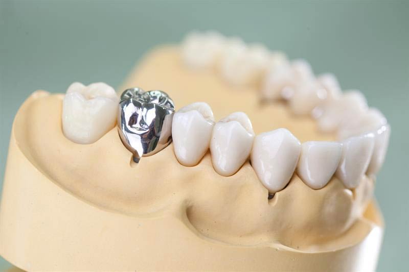 DENTAL PRO - THEODOROU ATHANASIOS & IOANNA O.E.: Φωτογραφίες & Βίντεο