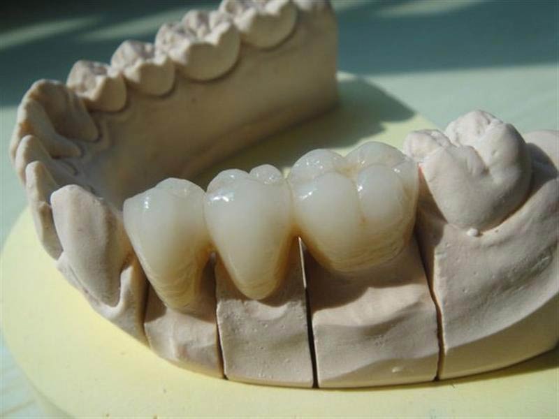 DENTAL PRO - THEODOROU ATHANASIOS & IOANNA O.E.: Φωτογραφίες & Βίντεο