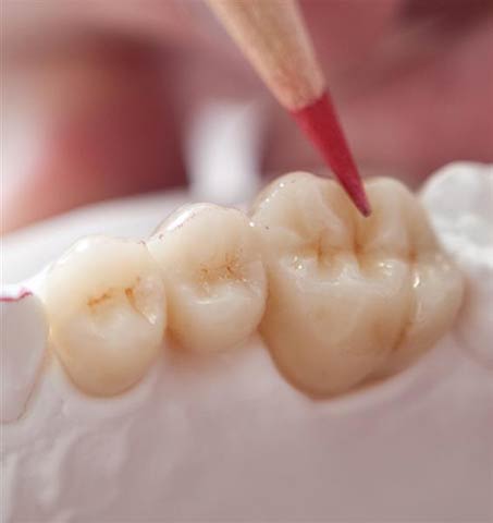 DENTAL PRO - THEODOROU ATHANASIOS & IOANNA O.E.: Φωτογραφίες & Βίντεο
