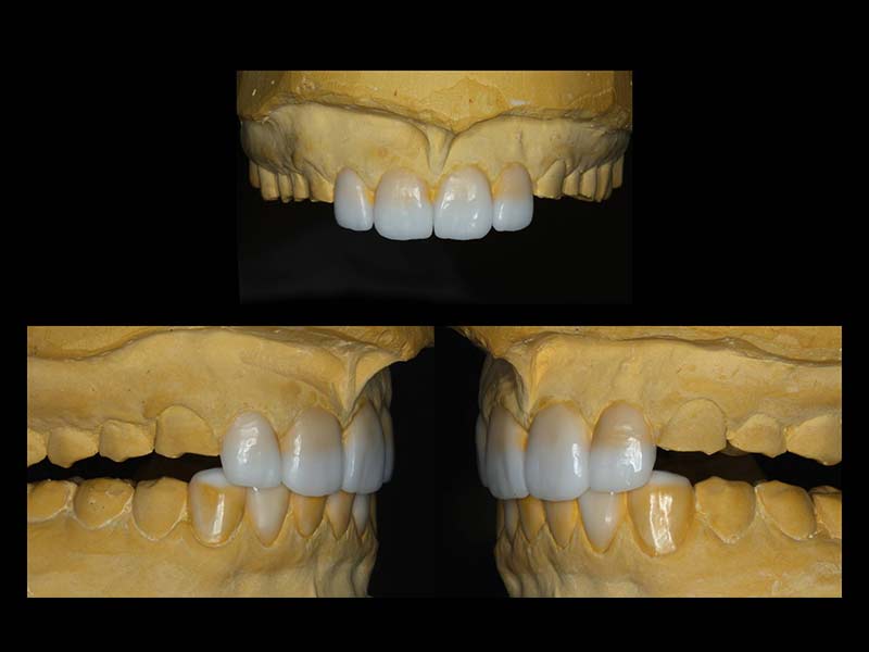 DENTAL SLEEP MEDICINE - TSOUTIS KONSTANTINOS: Φωτογραφίες & Βίντεο