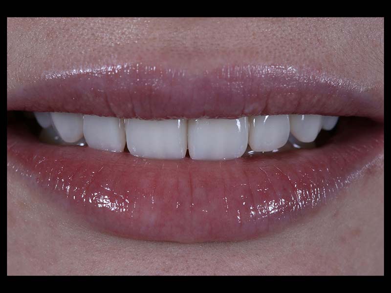 DENTAL SLEEP MEDICINE - TSOUTIS KONSTANTINOS: Φωτογραφίες & Βίντεο