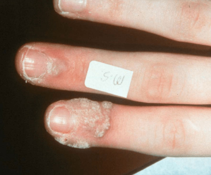 DERMACEN - DERMATOLOGIKO KENTRO A.E.: Φωτογραφίες & Βίντεο